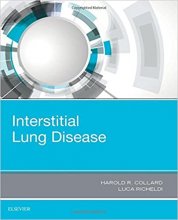 خرید کتاب اینترستیشال لانگ دیزیز Interstitial Lung Disease2017