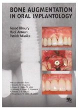 خرید Bone Augmentation in Oral Implantology