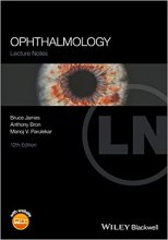 خرید کتاب لکچر نوت آفتالمولوژی Lecture Notes Ophthalmology